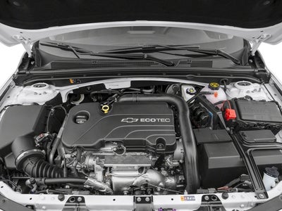 2017 Chevrolet Malibu 1LT